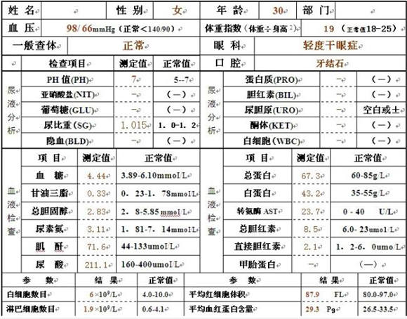 轻松掌握CANOpen最难理解的对象字典